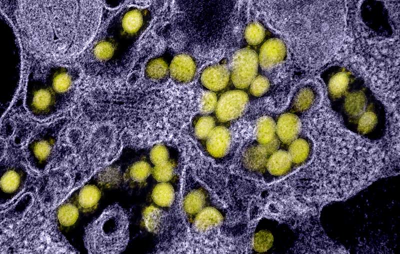 Penyidik Penyakit: Melacak Virus Tak Kasat Mata